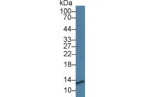 Detection of PRCP in Mouse Kidney lysate using Polyclonal Antibody to Prolylcarboxypeptidase (PRCP) (PRCP antibody  (AA 169-443))