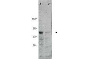 Image no. 1 for anti-CCCTC-Binding Factor (Zinc Finger Protein)-Like (CTCFL) (AA 9-26) antibody (ABIN199968) (CTCFL antibody  (AA 9-26))