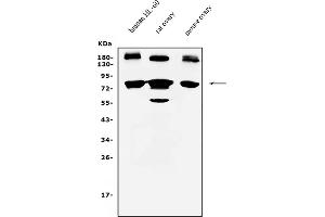 Western blot analysis of PRDM5 using anti-PRDM5 antibody (ABIN7600853).