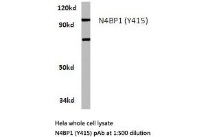 Western blot (WB) analysis of N4BP1 antibody in extracts from Hela cells.