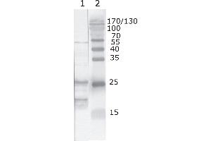Western Blot testing of HIV-1 recombinant Tat protein. (HIV-1 Tat antibody  (AA 2-9))