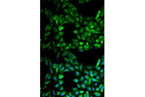 Immunofluorescence analysis of MCF7 cell using IKBKG antibody. (IKBKG antibody  (AA 1-419))