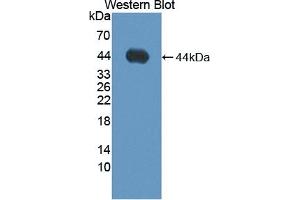 Detection of Recombinant ADAMTS19, Human using Polyclonal Antibody to A Disintegrin And Metalloproteinase With Thrombospondin 19 (ADAMTS19) (ADAMTS19 antibody  (AA 325-686))