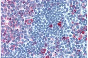 CELSR1 antibody  (C-Term)