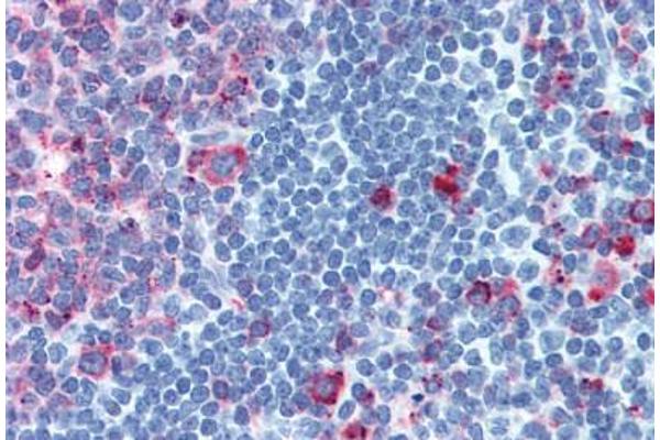 CELSR1 antibody  (C-Term)