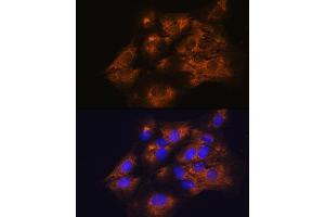 Immunofluorescence (IF) image for anti-Serpin Peptidase Inhibitor, Clade G (C1 Inhibitor), Member 1 (SERPING1) (AA 201-500) antibody (ABIN3022430)