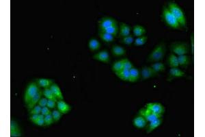 Immunofluorescent analysis of PC-3 cells using ABIN7153293 at dilution of 1:100 and Alexa Fluor 488-congugated AffiniPure Goat Anti-Rabbit IgG(H+L) (GRK4 antibody  (AA 1-245))