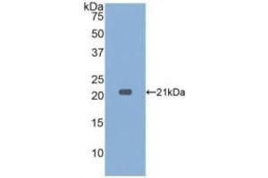 Detection of Recombinant TNFa, Rabbit using Polyclonal Antibody to Tumor Necrosis Factor Alpha (TNFa) (TNF alpha antibody  (AA 80-235))