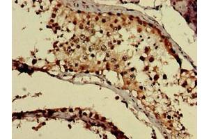 Immunohistochemistry of paraffin-embedded human testis tissue using ABIN7154703 at dilution of 1:100 (GNAQ antibody  (AA 1-359))