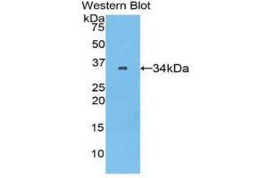 Western Blotting (WB) image for anti-Serpin Family A Member 7 (SERPINA7) (AA 128-415) antibody (ABIN3208849) (SERPINA7 antibody  (AA 128-415))