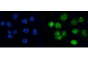 IF analysis of BRCC36/BRCC3 using anti-BRCC36/BRCC3 antibody (ABIN7599595). (BRCC3 antibody  (AA 10-276))