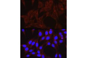 Immunofluorescence analysis of NIH/3T3 cells using PIK3C3/VPS34 Rabbit pAb (ABIN6134410, ABIN6145632, ABIN6145634 and ABIN6216127) at dilution of 1:50 (40x lens). (PIK3C3 antibody  (AA 150-250))