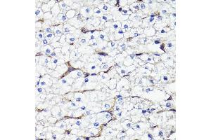 Immunohistochemistry of paraffin-embedded human liver using CD44 antibody (ABIN7266201) at dilution of 1:100 (40x lens). (CD44 antibody  (AA 346-385))