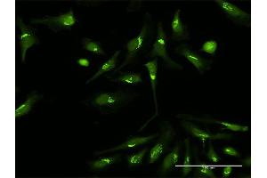 Immunofluorescence of purified MaxPab antibody to PDXDC1 on HeLa cell. (PDXDC1 antibody  (AA 1-788))