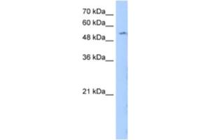 Western Blotting (WB) image for anti-Limb Region 1 Homolog (LMBR1) antibody (ABIN2463288) (LMBR1 antibody)