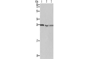 Western Blotting (WB) image for anti-Proteasome (Prosome, Macropain) 26S Subunit, Non-ATPase, 9 (PSMD9) antibody (ABIN2428649)