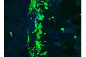 Image no. 1 for anti-Desmin (DES) antibody (ABIN335360) (Desmin antibody)