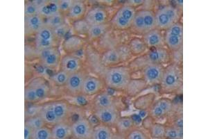 IHC-P analysis of Mouse Tissue, with DAB staining. (Dystrophin antibody  (AA 3059-3314))