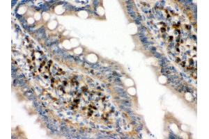 Anti- eIF4A2 Picoband antibody, IHC(P) IHC(P): Rat Intestine Tissue