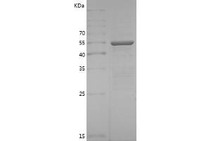 Western Blotting (WB) image for TNF Receptor-Associated Factor 3 (TRAF3) (AA 323-565) protein (GST tag) (ABIN7281759) (TRAF3 Protein (AA 323-565) (GST tag))