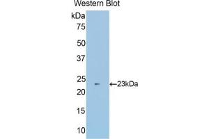 WB of Protein Standard: different control antibodies against Highly purified E. (SUOX ELISA Kit)