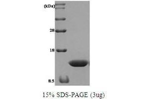 Figure annotation denotes ug of protein loaded and % gel used. (TXN Protein)