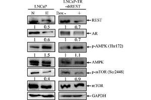 Western Blotting (WB) image for anti-Glyceraldehyde-3-Phosphate Dehydrogenase (GAPDH) antibody (ABIN2857072)