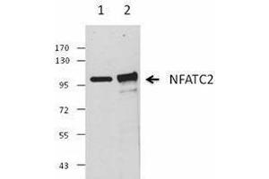 Western Blotting (WB) image for anti-Nuclear Factor of Activated T-Cells, Cytoplasmic, Calcineurin-Dependent 2 (NFAT1) antibody (ABIN2665286) (NFAT1 antibody)