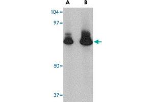 Western blot analysis of ATG16L1 in HeLa cell lysate with ATG16L1 polyclonal antibody  at (A) 1 and (B) 2 ug/mL .