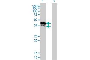 Western Blot analysis of GPD2 expression in transfected 293T cell line by GPD2 monoclonal antibody (M02), clone 2C11-1F4. (GPD2 antibody  (AA 1-378))