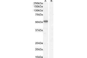 (ABIN570827) (1 μg/mL) staining of Mouse Heart lysate (35 μg protein in RIPA buffer). (IKZF4 antibody  (Internal Region))