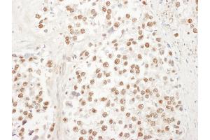 Immunohistochemistry (IHC) image for anti-Ubiquitin-Like 7 (Bone Marrow Stromal Cell-Derived) (UBL7) (AA 330-380) antibody (ABIN7454886) (UBL7 antibody  (AA 330-380))