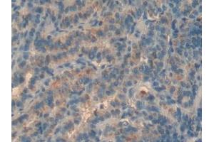 Detection of MBP in Human Thyroid Tissue using Polyclonal Antibody to Major Basic Protein (MBP) (Major Basic Protein antibody  (AA 105-222))