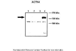 Lanes:   Lane1: 10 ug ACTN1-GFP transfected COS-7 lysate Lane2: 10 ug ACTN2-GFP transfected COS-7 lysate Lane3: 10 ug ACTN3-GFP transfected COS-7 lysate Lane4: 10 ug ACTN4-GFP transfected COS-7 lysate  Primary Antibody Dilution:   1: 1000  Secondary Antibody:   Anti-rabbit HRP  Secondary Antibody Dilution:   1:5000  Gene Name:   ACTN4  Submitted by:   Johannes W. (alpha Actinin 4 antibody  (N-Term))