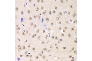 Immunohistochemistry of paraffin-embedded mouse brain using PRPF3 Antibody (ABIN5973192) at dilution of 1/100 (40x lens). (PRPF3 antibody)