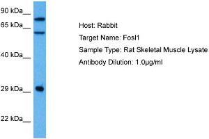Western Blotting (WB) image for anti-FOS-Like Antigen 1 (FOSL1) (Middle Region) antibody (ABIN2777265)