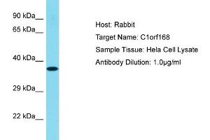 Host: Rabbit Target Name: C1ORF168 Sample Tissue: Human Hela Whole cell Antibody Dilution: 1ug/ml (C1ORF168 antibody  (N-Term))