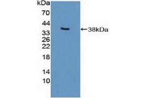 Western blot analysis of recombinant Human EP300. (p300 antibody  (AA 1351-1601))