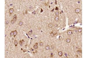 Paraformaldehyde-fixed, paraffin embedded rat brain, Antigen retrieval by boiling in sodium citrate buffer (pH6) for 15min, Block endogenous peroxidase by 3% hydrogen peroxide for 30 minutes,  Blocking buffer (normal goat serum) at 37°C for 20min, Antibody incubation with Pyk2 (Tyr402) Polyclonal Antibody (bs-3400R) at 1:400 overnight at 4°C, followed by a conjugated secondary and DAB staining. (PTK2B antibody  (pTyr402))