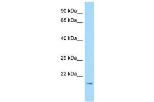 WB Suggested Anti-DAND5 Antibody Titration: 1.