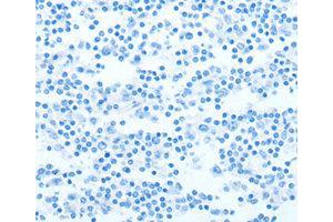 Immunohistochemistry (IHC) image for anti-Neurotrophin 4 (NTF4) antibody (ABIN1873970)