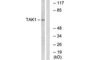 Western blot analysis of extracts from HepG2 cells, using TAK1 (Ab-184) Antibody.