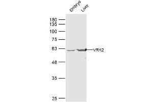 Lane 1: mouse embryo lysates Lane 2: mouse liver lysates probed with VRK2 Polyclonal Antibody, Unconjugated  at 1:300 dilution and 4˚C overnight incubation. (VRK2 antibody  (AA 151-250))