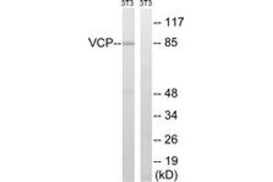 Western blot analysis of extracts from NIH-3T3 cells, treated with starved 24h, using VCP (Ab-352) Antibody. (VCP antibody  (AA 318-367))
