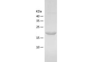 Western Blotting (WB) image for tRNA Splicing Endonuclease 15 Homolog (TSEN15) (AA 1-171) protein (His tag) (ABIN7125500) (TSEN15 Protein (AA 1-171) (His tag))