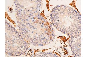 Immunohistochemistry (IHC) image for anti-Tumor Protein P53 (TP53) (acLys319) antibody (ABIN6254862)