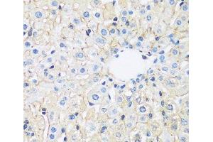 Immunohistochemistry of paraffin-embedded Rat liver using ARL4A Polyclonal Antibody at dilution of 1:100 (40x lens). (ARL4A antibody)