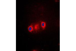 Immunofluorescent analysis of Cytochrome P450 2J2 staining in A549 cells. (CYP2J2 antibody  (Center))
