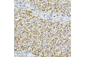 Immunohistochemistry (IHC) image for anti-Complement Component 1, Q Subcomponent Binding Protein (C1QBP) antibody (ABIN7266473)
