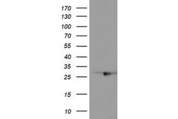 RABL2A antibody